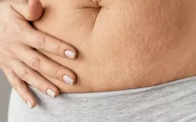 L’acupuncture peut-elle m’aider avec mes hormones ?